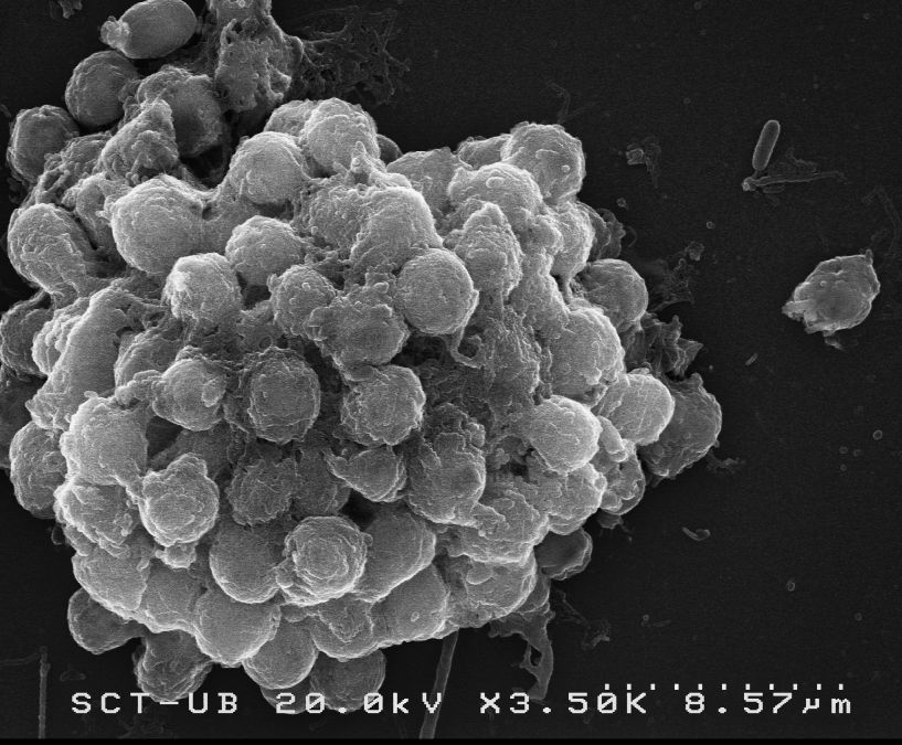 Scanning electron micrograph of a Capsaspora owczarzaki cell aggregate