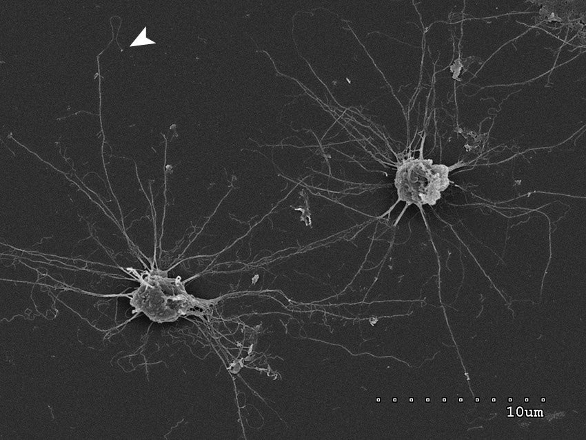 Capsaspora cells connected by long filopodia