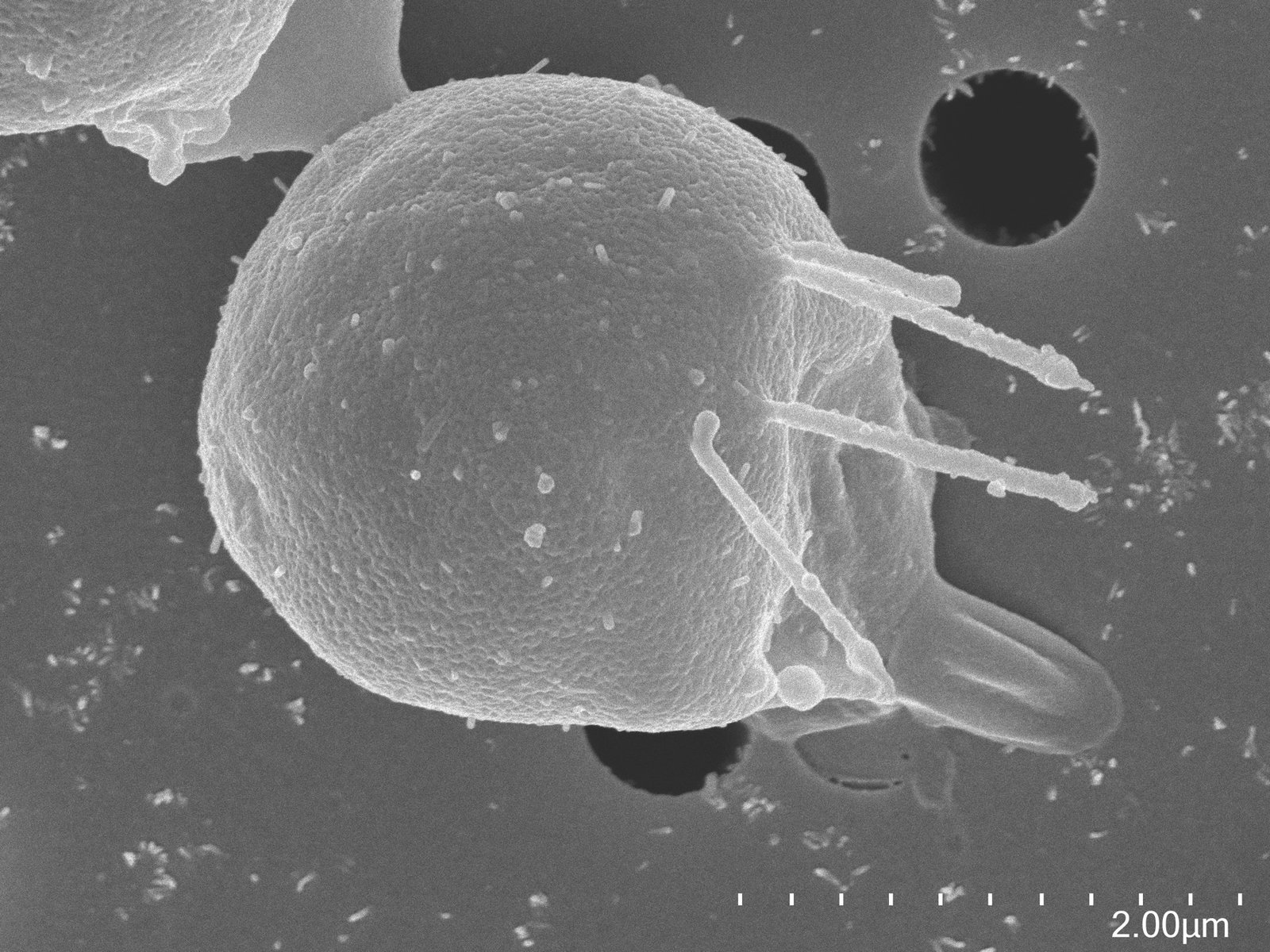 Research image associated with Corallochytrium limacisporum