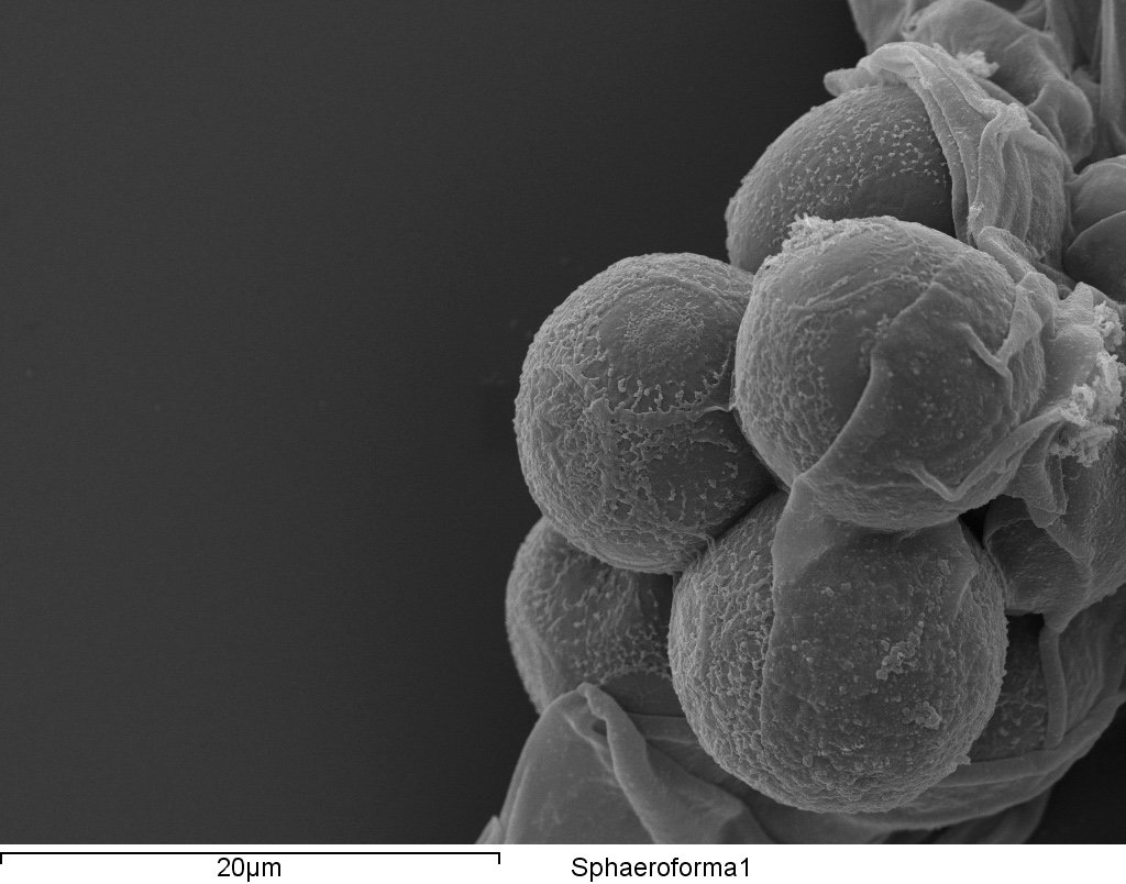 Scanning electron micrograph of newborn Sphaeroforma daughter cells