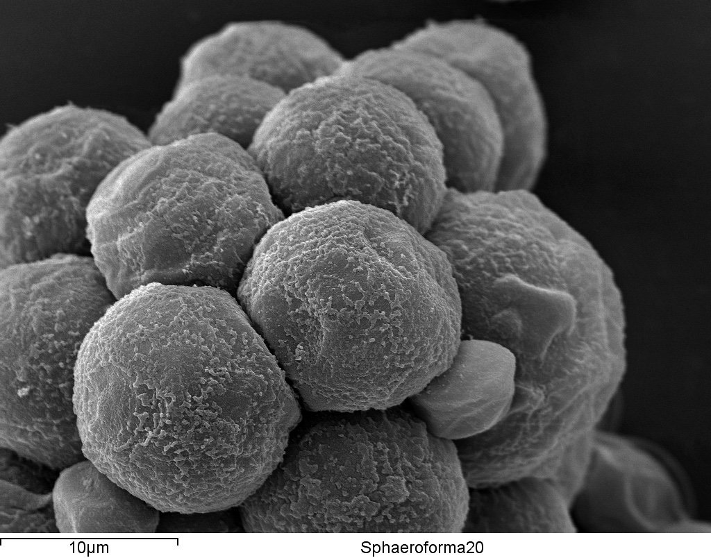 Scanning electron micrograph of newborn Sphaeroforma arctica cells emerging after cellularisation